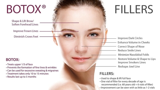 Les rides enlèvent l'injection botulinum turque de BTX de toxine d'Allergan 100iu pour le visage