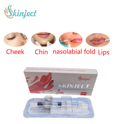 Remplisseurs cutanés des lèvres 2ml d'acide hyaluronique profond de Skinject injectables