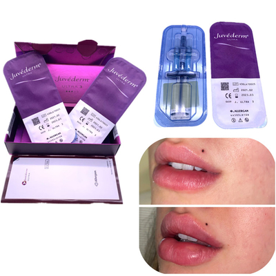 L'amélioration de lèvre de Juvederm 2x1ml de remplisseur d'ha d'injection enlèvent des rides