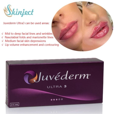Injectable cutané d'acide hyaluronique de remplisseurs de lèvre du soin 2x1ml Juvederm de visage