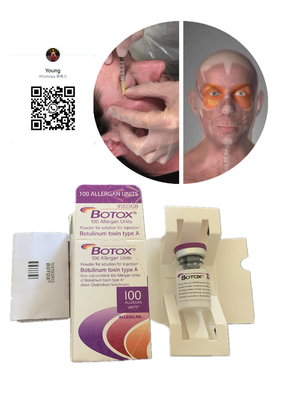 Retrait Allergan  de ride 100 unités pour âge d'injection de lifting l'anti