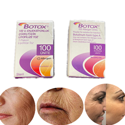 Type d'édition en anglais une toxine botulinum 100 unité internationale Allergan  pour des rides