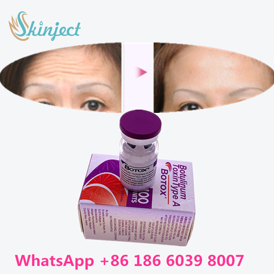La toxine botulinum  rident le retrait 100u Allergan 100 unités pour l'injection de lifting