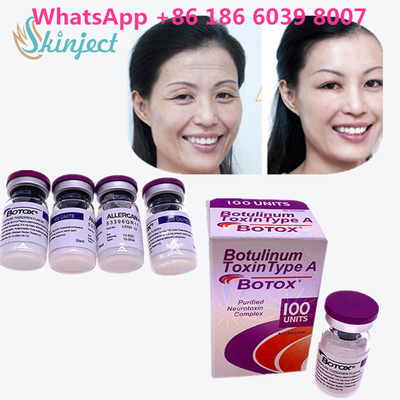 La toxine botulinum  rident le retrait 100u Allergan 100 unités pour l'injection de lifting
