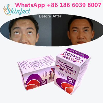 Toxine botulinum Allergan s 1x100iu pour les rides faciales
