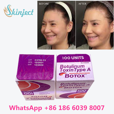 Toxine botulinum Allergan s 1x100iu pour les rides faciales