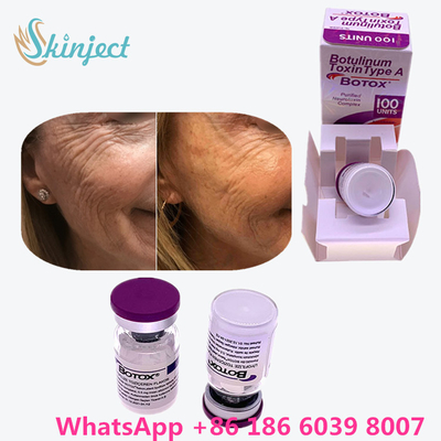 Fiole/boîte botulinum d'Allergan  100 unité internationale 200ui 1 de toxine