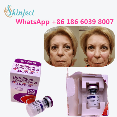 Type botulinum A de toxine d'Allergan  pour les produits anti-vieillissement de peau