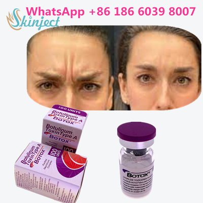Type botulinum A de toxine d'Allergan  pour les produits anti-vieillissement de peau