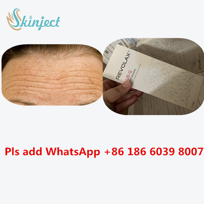 Remplisseur cutané injectable Revolax 24 mg/ml injection d'acide hyaluronique d'ha
