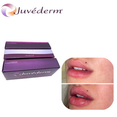 Remplisseur cutané injectable Ultra3 Ultra4 Voluma pour la lèvre de pommette