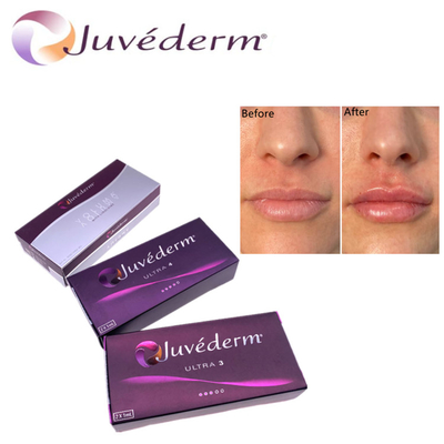 Le remplissage cutané à l' acide hyluronique Premium Juvederm HA Facial Filler Ultra3 Ultra4 Volume Pour le rajeunissement du visage