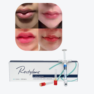 Vital  Perlane Cross Linked Dermal Filler Acide hyaluronique Lift Fillers cutanés