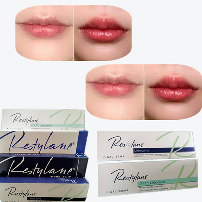 2*1 ml/ boîte de remplissage cutané à l' acide hyaluronique pour augmentation des lèvres