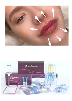 Juvederm' Acide hyaluronique remplisseur cutané Ultra3 Ultra4 Volume Injection pour remplissage des lèvres