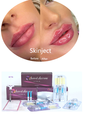 Juvederm Acide hyaluronique Remplisseur cutané pour le visage Injectable 2*1 ml Emballage