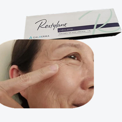 L'acide hyaluronique est un produit de remplissage du visage pour les rides nasales.