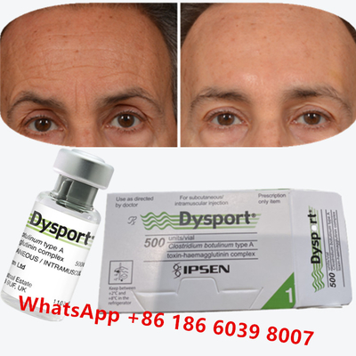 Dysport de la toxine botulique Clostridium botulinum type A pour les pattes de corbeau