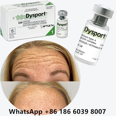 Dysport de la toxine botulique Clostridium botulinum type A Pour les rides du front