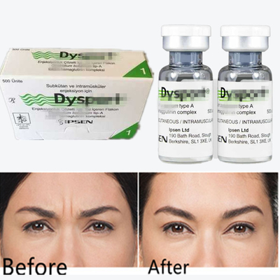 Poudre anti-rides de la toxine botulique dysportive Poudre lyophilisée pour les lignées glabellaires