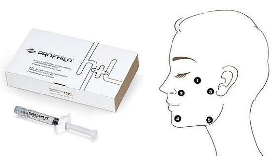 Anti-âge et élimination des rides Profhilo H L 2 ml d'acide hyaluronique avec une concentration de 32 mg/ml Ha