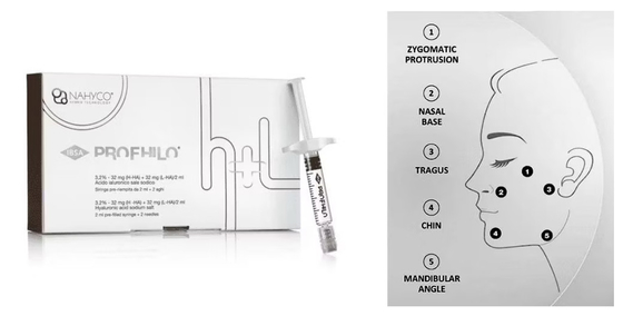 Fil de lifting 5 points Profhilo, produit de comblement injectable pour la peau, effet naturel