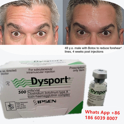 Botulinum Toxin Dysport Botox Clostridium Botulinum type A Pour le lifting des sourcils