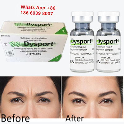 Toxine botulique A Dysport injectable Botox pour augmentation du menton
