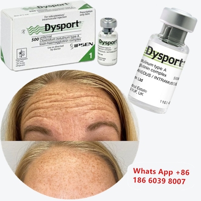 Toxine botulique Dysport Clostridium Botulinum Type A pour correction du nez