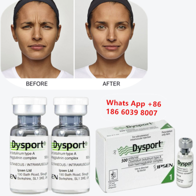 Toxine botulique dysportive de type A pour les lignées frown et glabelaires