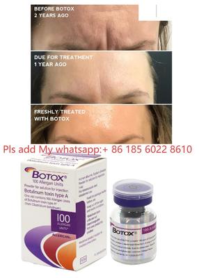 Allergan Botox 100UI Dysport Injection Toxine Botulique Botulax Éliminer les Rides