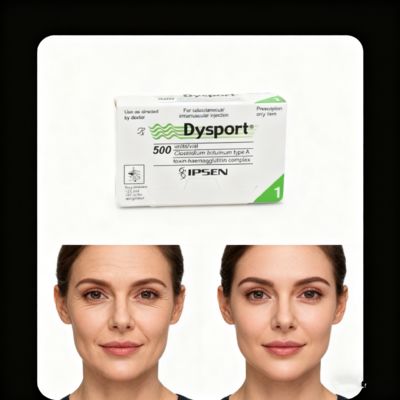 Toxine botulique 500U Dysport Réduit les rides du visage et restaure la douceur de la peau