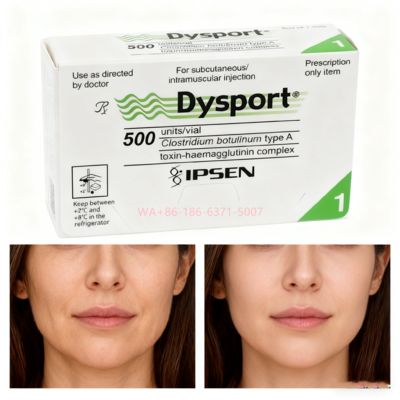 Toxine botulique 500U Dysport Réduit les rides du visage et restaure la douceur de la peau