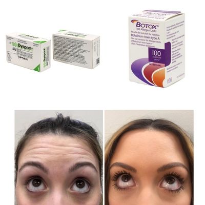 100 unités Corée BTX Toxine botulique pour les rides et les lignes fines