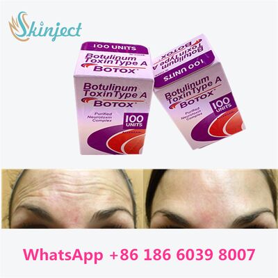Botox Allergan Toxine Botulique Type A 100 Unités pour l'Élimination des Rides avec une Durée de 4 à 6 Mois