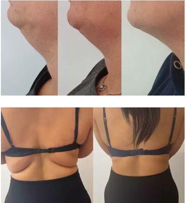 Solution liposolubles de la bouteille de citron naturel