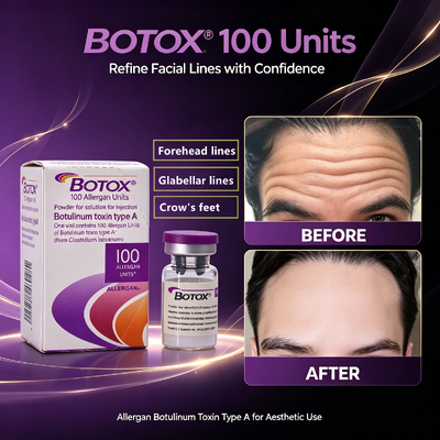 BOTOX 100 unités Injection anti-rides Traitement esthétique du visage Allergène Toxine botulique de type A