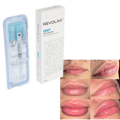 Revolax Acide hyaluronique Remplisseur cutané Plume naturelle Augmentation des lèvres Restauration du volume facial