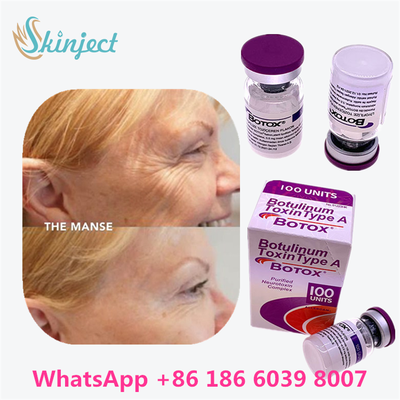 Toxine botulique BOTOX Cosmétique 100 Unités Allergène OnabotulinumtoxinA pour les rides du visage