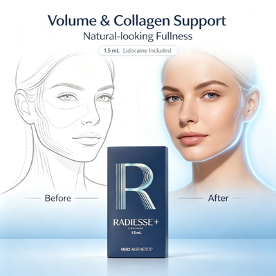 Injection de Radiesse, combleur stimulant le collagène pour le visage, correction immédiate des rides profondes