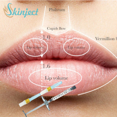 Remplisseur cutané injectable 1ml 2ml 5ml d'ha d'acide hyaluronique de remplisseur de pleine joue de lèvre