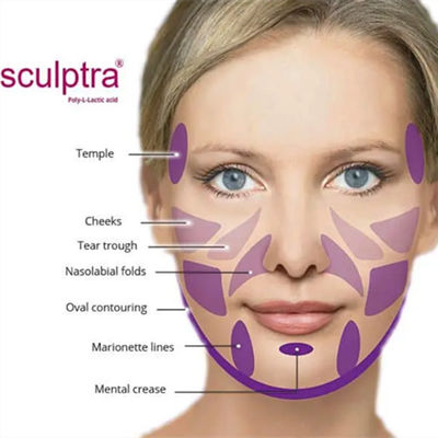 La poudre de  PLLA de la CE pour stimule le collagène