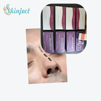 Remplisseur cutané d'acide hyaluronique Juvederm Ultra3 pour des lèvres