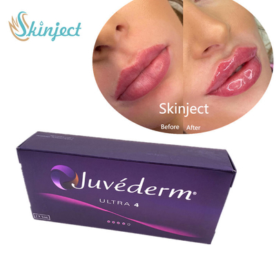 Remplisseur cutané d'acide hyaluronique de remplisseur de lèvres de Juvederm 2*1ml avec la piscine découverte Ultra4