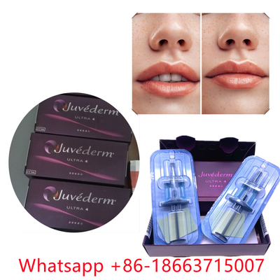 Élargissement cutané injectable de lèvre du remplisseur ultra 4 de Juvederm (2x1ml)