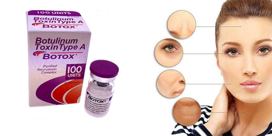 Type botulinum de toxine d'Allergan une forme de poudre de