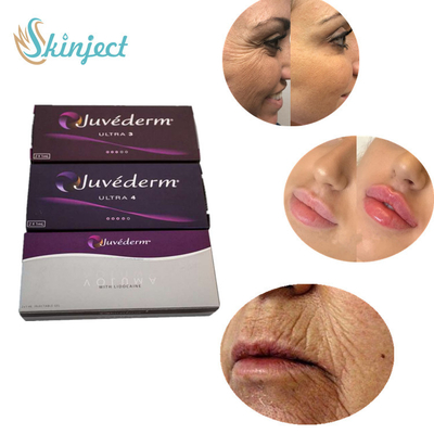 Juvederm ultra 4 injections cutanées de lèvre de remplisseur pour l'amélioration sexy de lèvres