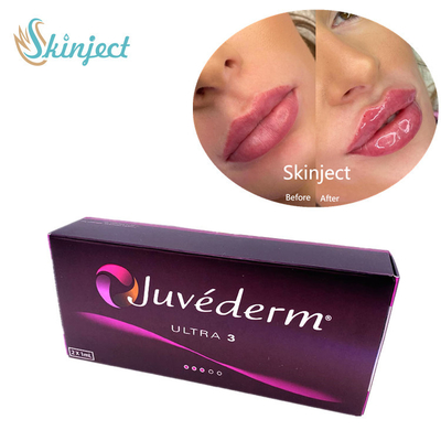 Remplisseurs faciaux d'acide hyaluronique de Juvederm Ultra3 2x1ml cutanés