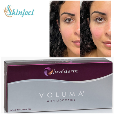 Remplisseurs cutanés de Juvederm Voluma 2x1ml ha pour la pommette Chin Contouring