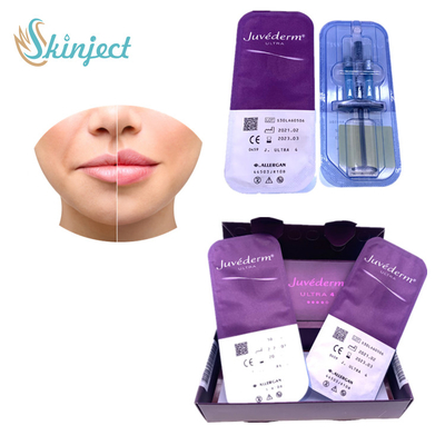 Acide hyaluronique cutané de remplisseurs d'élargissement de lèvre de Juvederm Ultra4